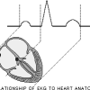 استخراج ویژگی های سیگنال ECG قلب با متلب