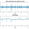 شبیه سازی مقاله پردازش سیگنال مغزی EEG با متلب