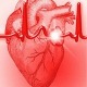 پیش بینی بیماری های قلبی و عروقی با استفاده از تکنیک های داده کاوی با متلب