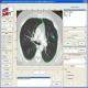 تحقیق کاربرد نرم افزار متلب در سیستم های تصویرگر پرتوپزشکی