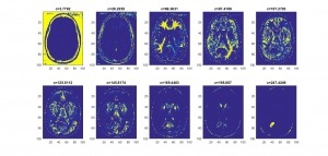 شبیه سازی مقاله تقسیم بندی تصاویر MRI برای تعیین تومور مغزی توسط الگوریتم ژنتیک با متلب
