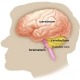 ترجمه شناسایی پتانسیل‌های قشر مغز مرتبط با حرکت مبتنی بر روش آموزش مستقل از شخص