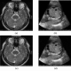 پروژه واترمارکینگ تصاویر MRI مغز با متلب