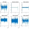 پروژه آموزشی استخراج امواج EEG با متلب
